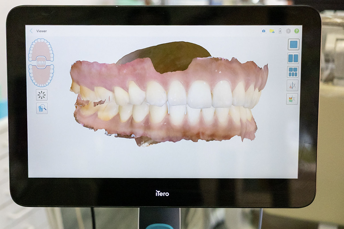 Dental Treatments in Tucson