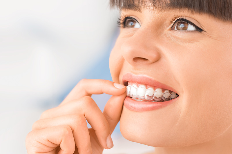 Invisalign in Oro Valley